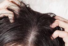 Để tóc ướt đi ngủ, bạn có thể gặp phải vô số tác hại ảnh hưởng nghiêm trọng tới sức khỏe - Kiến Thức Chia Sẻ 5