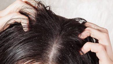 Để tóc ướt đi ngủ, bạn có thể gặp phải vô số tác hại ảnh hưởng nghiêm trọng tới sức khỏe - Kiến Thức Chia Sẻ 22