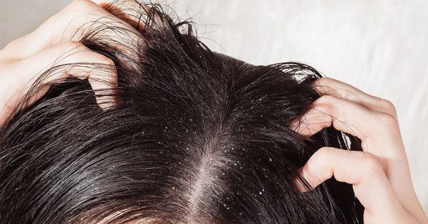 Để tóc ướt đi ngủ, bạn có thể gặp phải vô số tác hại ảnh hưởng nghiêm trọng tới sức khỏe - Kiến Thức Chia Sẻ 1