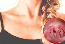 Những dấu hiệu của ung thư vòm họng mà chúng ta hay bỏ qua - Kiến Thức Chia Sẻ 9