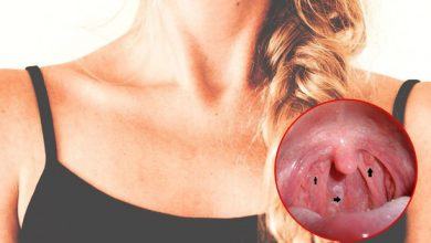 Những dấu hiệu của ung thư vòm họng mà chúng ta hay bỏ qua - Kiến Thức Chia Sẻ 7