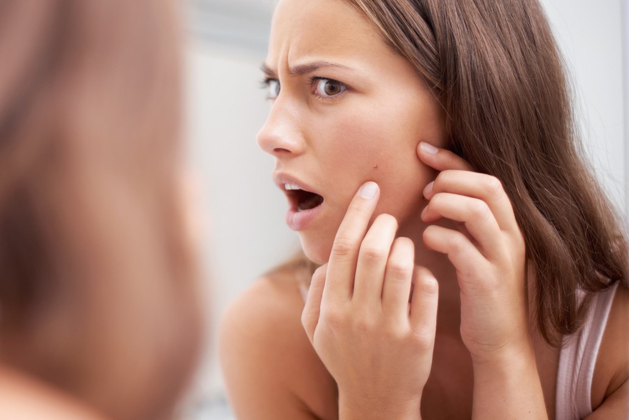Mọc mụn ở bất kỳ vị trí nào trên khuôn mặt cũng có thể ngầm cảnh báo một vài vấn đề sức khỏe đang xảy ra trong cơ thể bạn - Ảnh 2.
