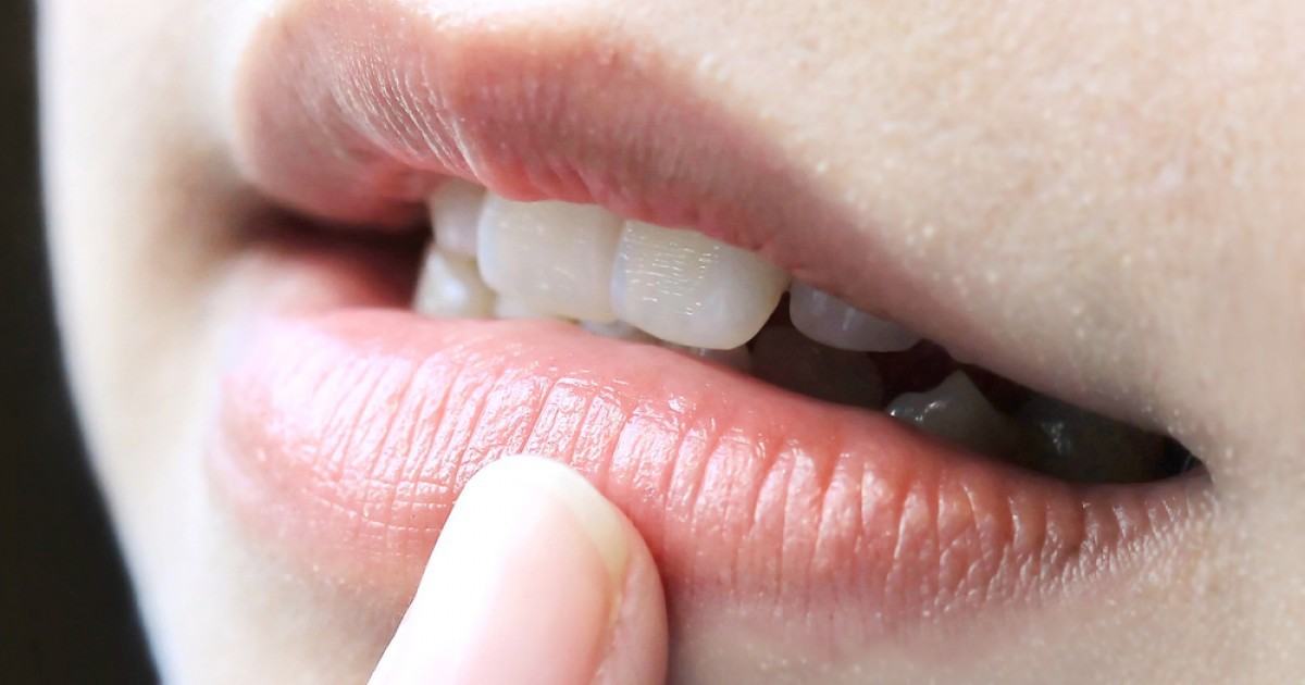 5 dấu hiệu bất thường ở đôi môi mà bạn không nên chủ quan bỏ qua - Ảnh 5.