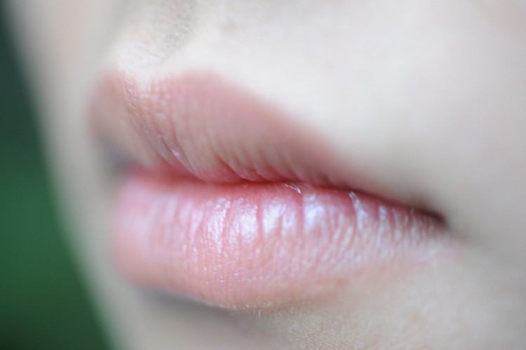 5 dấu hiệu bất thường ở đôi môi mà bạn không nên chủ quan bỏ qua - Ảnh 4.