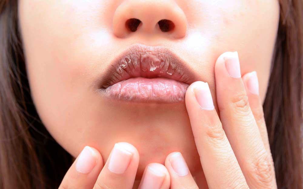 5 dấu hiệu bất thường ở đôi môi mà bạn không nên chủ quan bỏ qua - Ảnh 2.