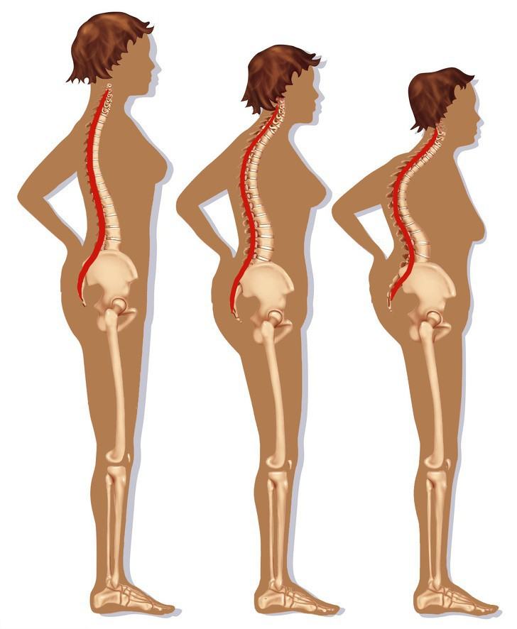 7 thói quen hàng ngày phá hủy cột sống của bạn dẫn đến những cơn đau lưng trầm trọng - Ảnh 2.