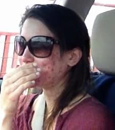 Cô gái người Mỹ kiên trì theo đuổi chế độ detox giúp đánh bay mụn chi chít trên khuôn mặt sau 1 năm - Ảnh 2.