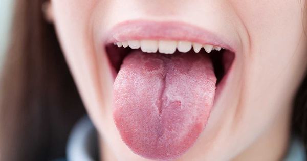 Những triệu chứng bất thường ở lưỡi có thể cảnh báo bạn đang mắc các căn bệnh nguy hiểm - Kiến Thức Chia Sẻ 1