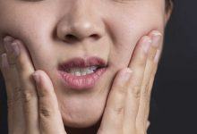 7 dấu hiệu nhận biết bệnh ung thư miệng mà bạn không nên bỏ qua - Kiến Thức Chia Sẻ 12