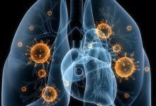 7 biện pháp phòng tránh bệnh ung thư phổi - Kiến Thức Chia Sẻ 12