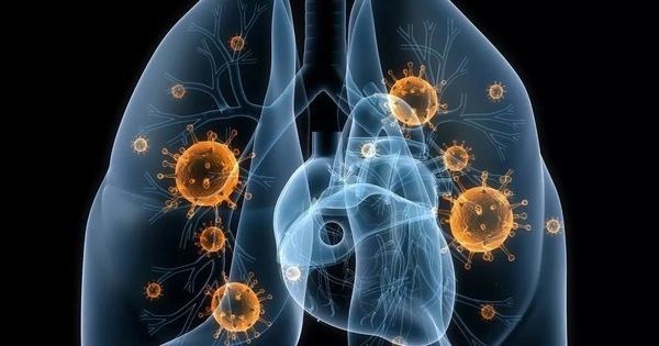 7 biện pháp phòng tránh bệnh ung thư phổi - Kiến Thức Chia Sẻ 1