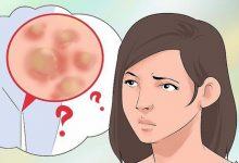 Những dấu hiệu cảnh báo bệnh viêm nấm âm đạo mà con gái không nên chủ quan bỏ qua - Kiến Thức Chia Sẻ 4
