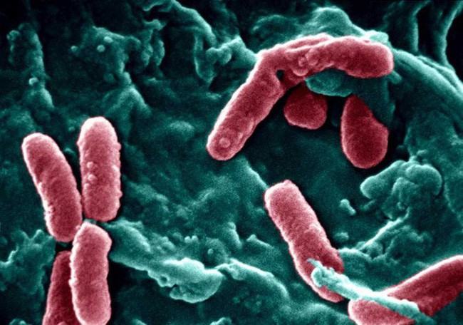Cảnh báo: 12 loại vi khuẩn kháng kháng sinh đáng sợ đang là mối đe dọa rất lớn đến sức khỏe con người - Ảnh 4.
