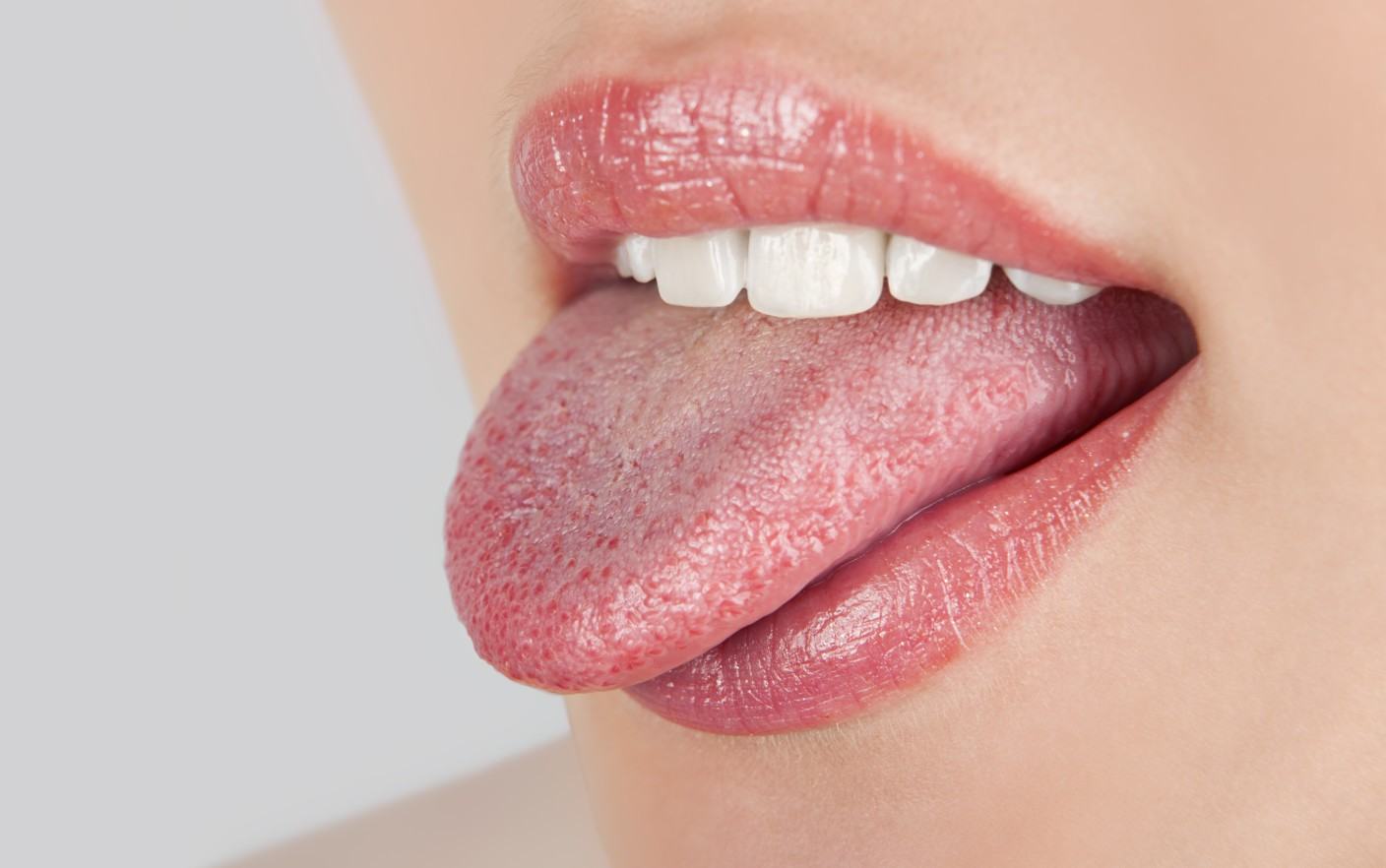 Những dấu hiệu bất thường ở vùng lưỡi cảnh báo một số vấn đề sức khỏe mà bạn không hề hay biết - Ảnh 2.