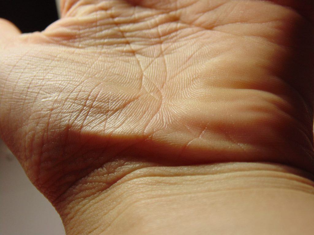 5 dấu hiệu của bệnh suy giáp thông qua các biểu hiện khác thường ở đôi bàn tay - Ảnh 1.