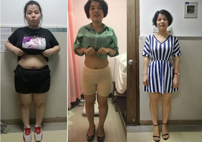 Cho rằng bác sĩ lừa mình vì không có cách giảm cân như thế nhưng cô gái vẫn làm theo và giảm tới 17,4kg - Ảnh 1.