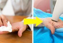 5 dấu hiệu bất thường xảy ra ở đôi bàn tay mà bạn không nên chủ quan bỏ qua - Kiến Thức Chia Sẻ 13