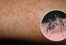 8 nguyên tắc ai cũng cần nhớ khi sốt xuất huyết vào "mùa" để tránh mắc bệnh - Kiến Thức Chia Sẻ 13