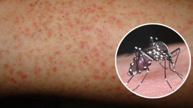 8 nguyên tắc ai cũng cần nhớ khi sốt xuất huyết vào "mùa" để tránh mắc bệnh - Kiến Thức Chia Sẻ 11