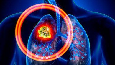 Ngăn ngừa ung thư phổi từ sớm nhờ duy trì 5 thói quen sau đây mỗi ngày - Kiến Thức Chia Sẻ 4