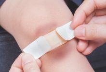 Cơ thể xuất hiện những vết bầm tím trên da cũng có thể cảnh báo một loạt vấn đề sức khỏe tiềm ẩn - Kiến Thức Chia Sẻ 8