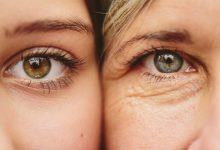 5 thói quen tưởng đơn giản nhưng giúp giảm bớt nếp nhăn ở vùng da dưới mắt cực hiệu quả - Kiến Thức Chia Sẻ 9
